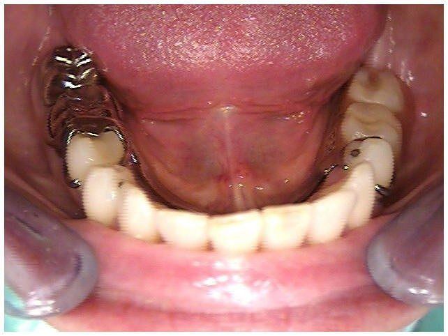 Initial Patient Presentation