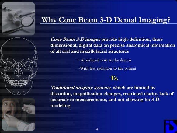 cone beam