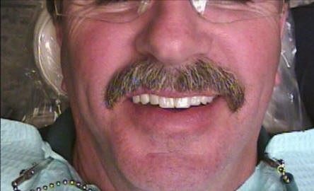 Improved Facial Aesthetics