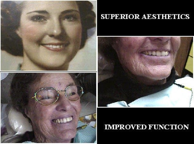 Dentistry for Seniors