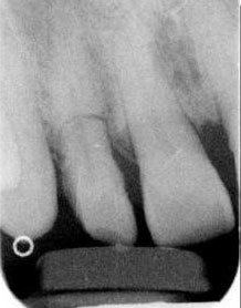 Radiograph