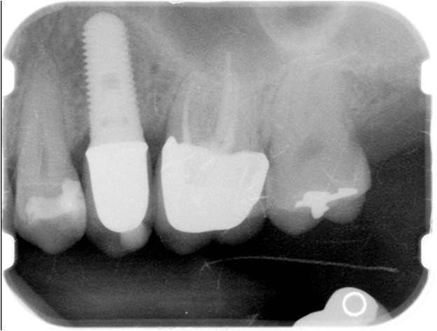 Post-Op Radiograph