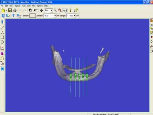 Pre-Op 3D (1)