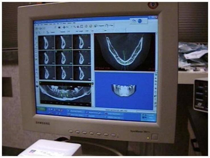 Intra-Operative Monitor