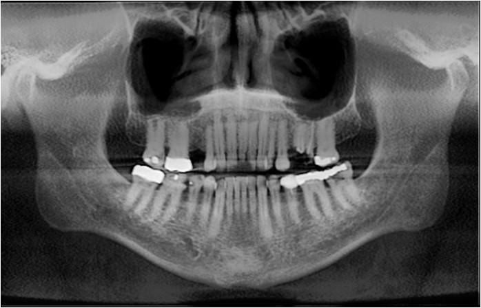 Pre-Op Radiographs