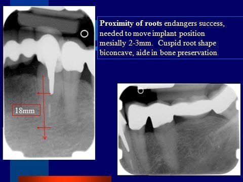 info5