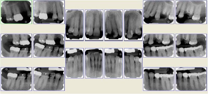 Pre-Op Radiographs