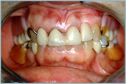  Initial Patient Presentation