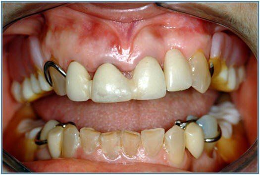 Initial Patient Presentation