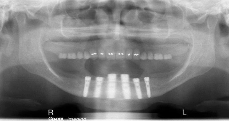 Post-Operative Radiograph