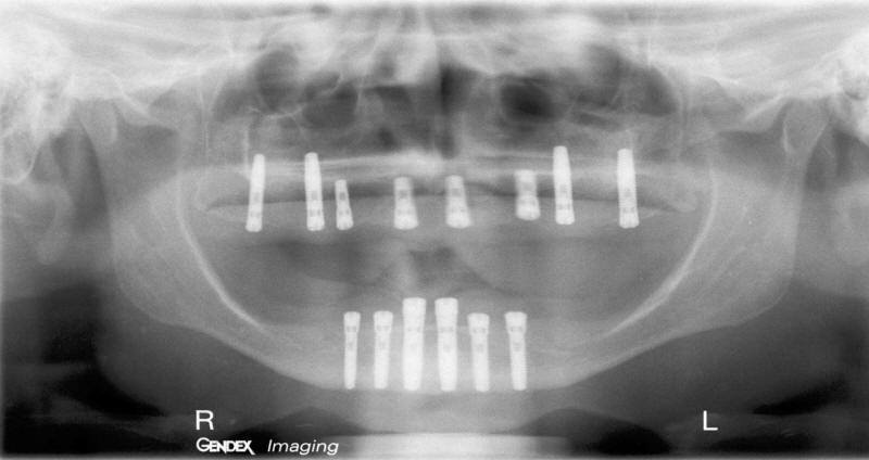 Post-Operative Radiograph