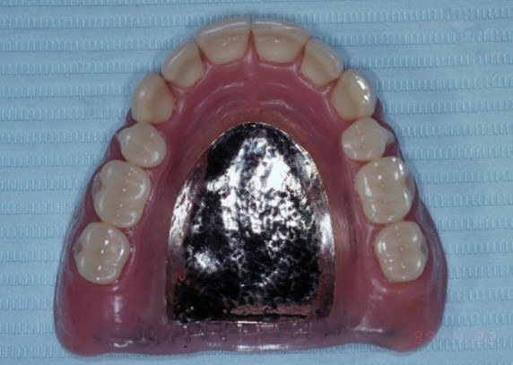 Maxillary Metal Base