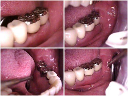 PHOTOGRAPHS OF CLINICAL COMPLETED