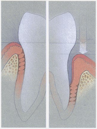 TEETH AND IMPLANTS