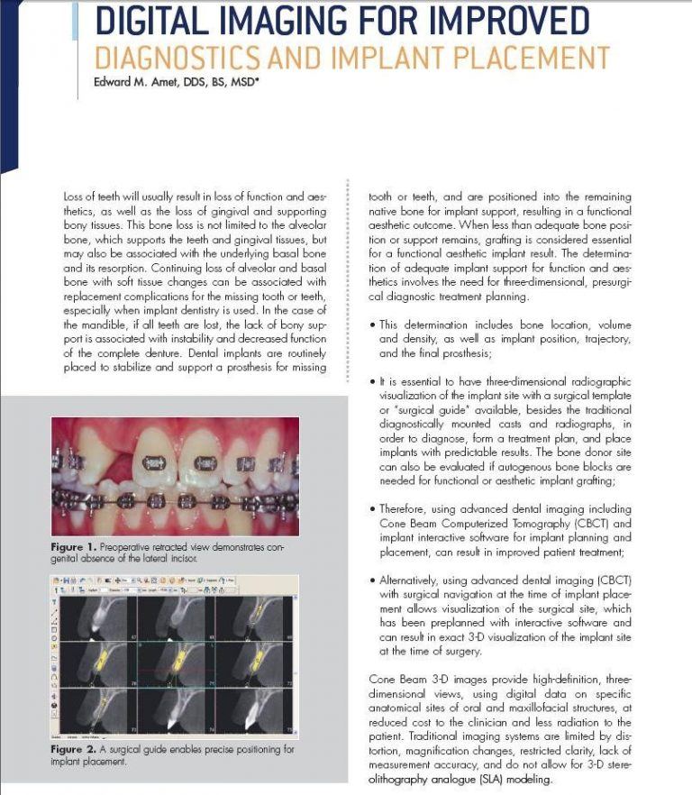 Digital Imaging for Improved Diagnostics and Implant Placement