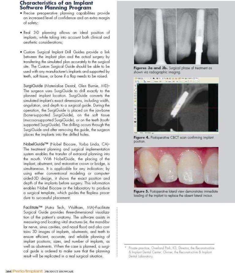 Digital Imaging for Improved Diagnostics and Implant Placement Prosthodontist Overland Park, KS