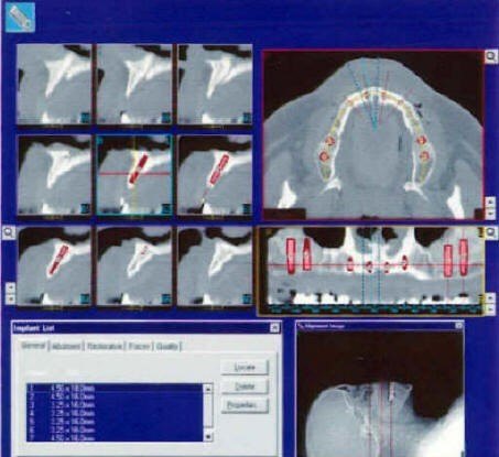 (CT Scan)3