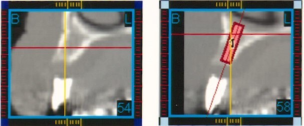 (CT Scan)6