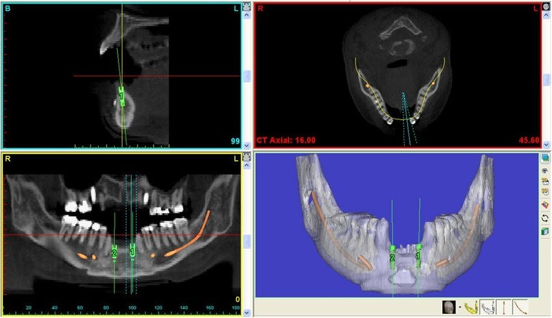 ortho18