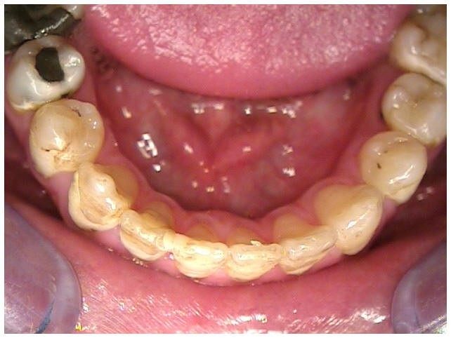 ortho4