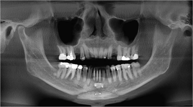 ortho5